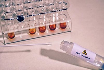 Testzahlen steigen, Positivrate bei 55,3 Prozent – Labore sind enttäuscht von neuer Coronavirus-Test- und Surveillance-verordnung