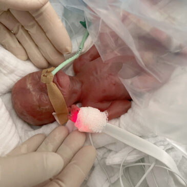 300-Gramm-Frühchen an der Universitätsmedizin Magdeburg erfolgreich ins Leben begleitet