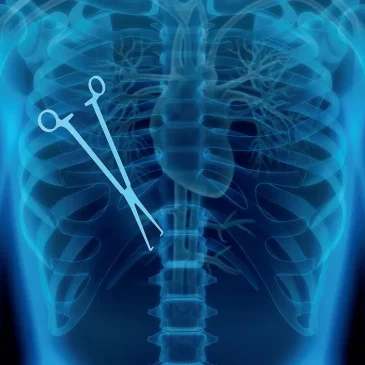 Medizinischer Dienst: Mehr als 3.700 Behandlungsfehler