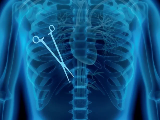 Medizinischer Dienst: Mehr als 3.700 Behandlungsfehler